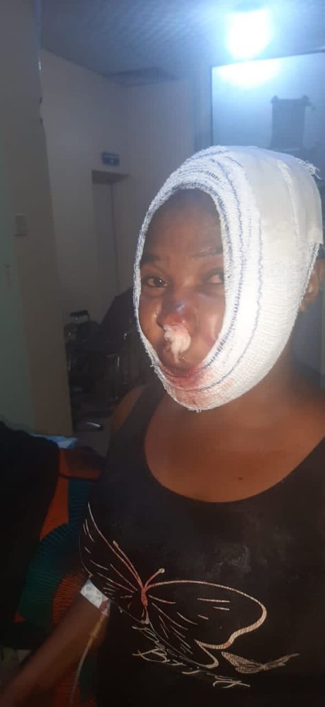 F5e5vfAWgAAD3I5-472x1024 Tension In Abuja Market As DSS Operatives Shoot 2