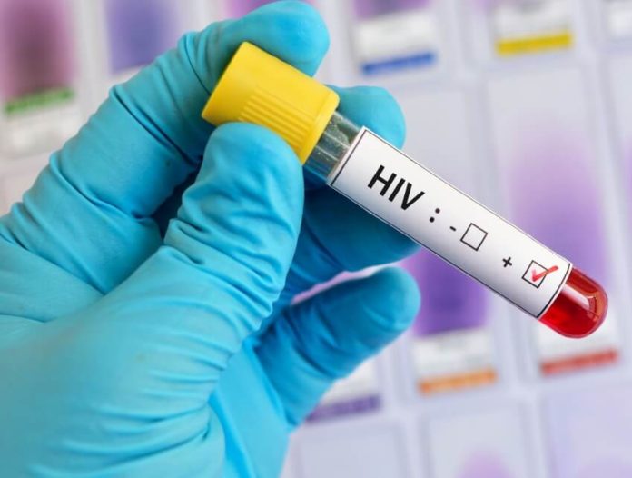 Two million people benefit from HIV/AIDS screening in Gombe