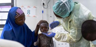 Suspected Measles Outbreak in Abuja Claims Lives of 10 Children