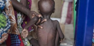 Hardship: Nigerian govt confirms over 4m children malnourished in Northeast, Northwest