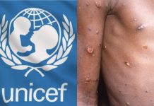 UNICEF seeks $59 million to tackle mpox in Burundi, DRC, four other African countries