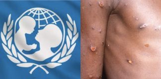 UNICEF seeks $59 million to tackle mpox in Burundi, DRC, four other African countries