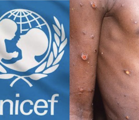 UNICEF seeks $59 million to tackle mpox in Burundi, DRC, four other African countries