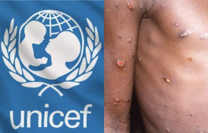 UNICEF seeks $59 million to tackle mpox in Burundi, DRC, four other African countries