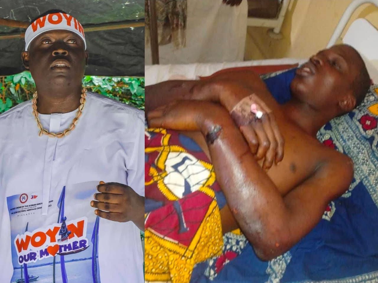 Patrick Peresousdei: Family Alleges Security Agencies Played a Role in His Death