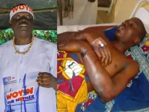 Autopsy Reveals Patrick Peresuodei Died of Hemorrhagic Shock from Severe Blunt Force Injuries, Pathologist Tells Court